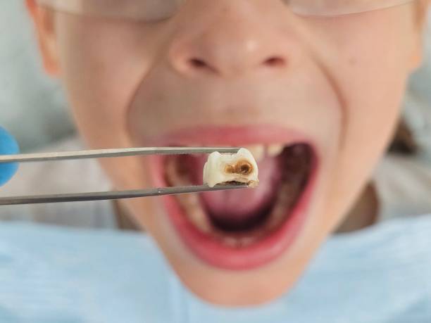 Best Emergency Denture Repair in Spring Arbor, MI