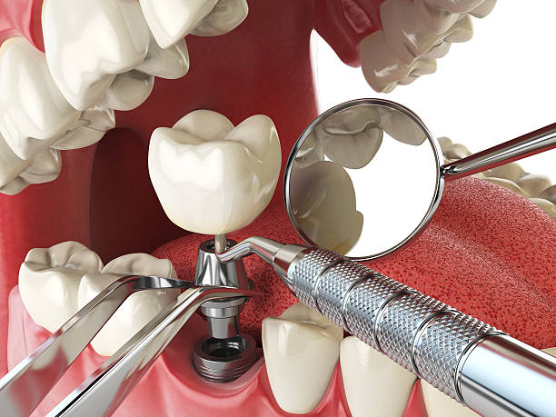Best Cosmetic Emergency Dentistry in Spring Arbor, MI